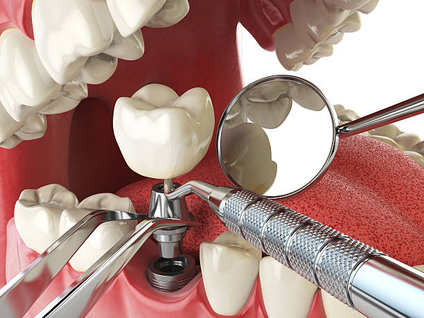 Best Broken Tooth Emergency  in Fritch, TX